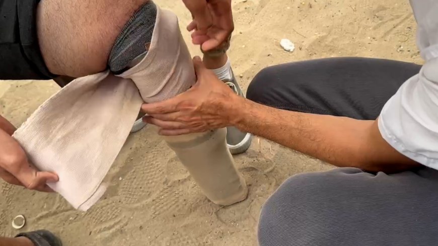 Palestinians create makeshift prosthetic limbs to help Gaza amputees