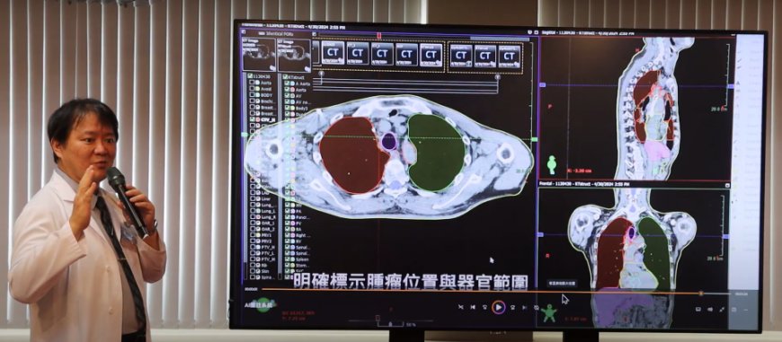 啟用3年累計5,000多個實例，臺中榮總用AI精準圈出放射治療範圍、提高器官保護力
