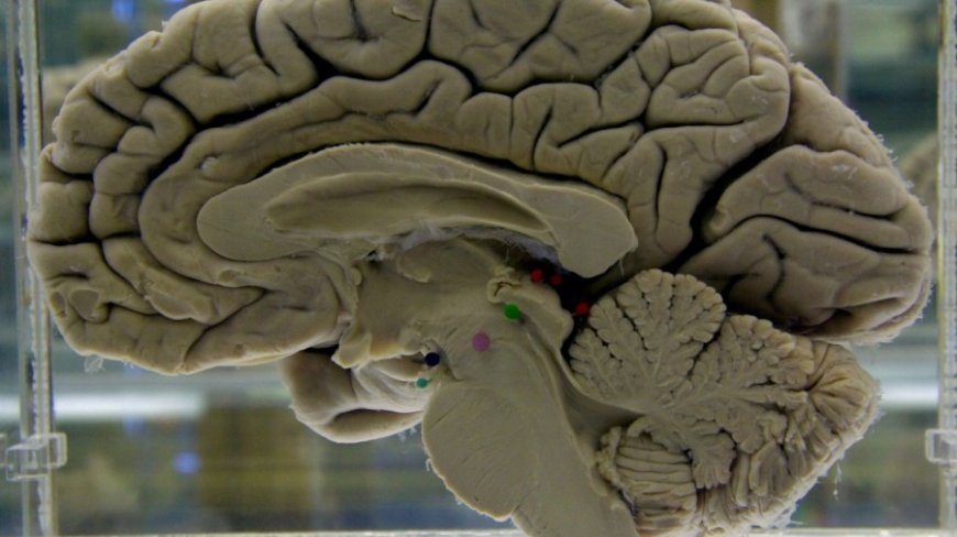 Scans show reorganization of brain during pregnancy